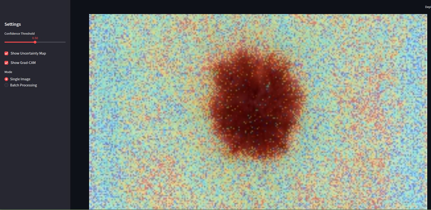 Medical Image Segmentation - Grad-CAM Visualization