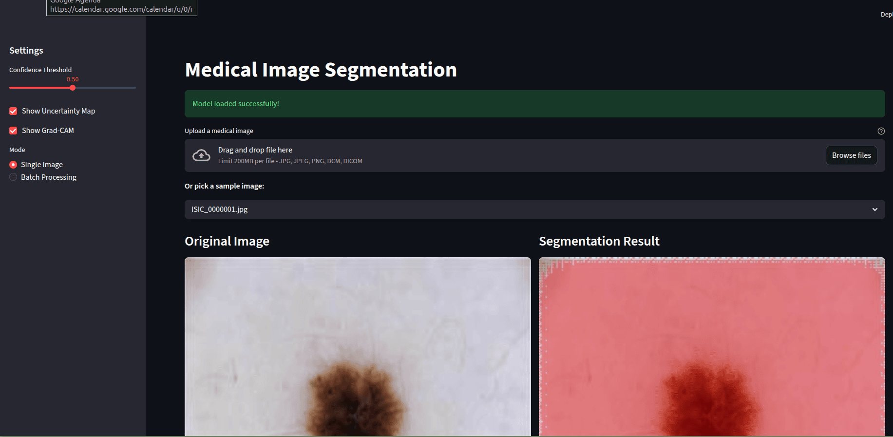 Medical Image Segmentation - Segmentation Result